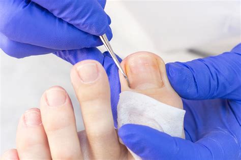 How to Have Healthy Toenails and Why They Might Secretly Control Your Mood